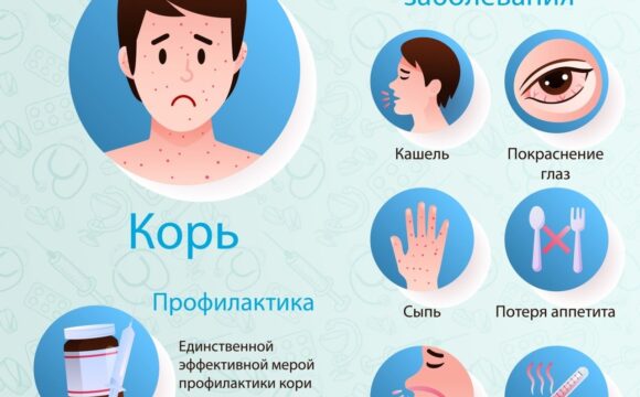 Профилактика кори и краснухи