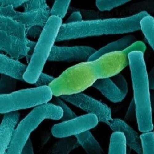 Сибирская язва. Симптомы и профилактика.