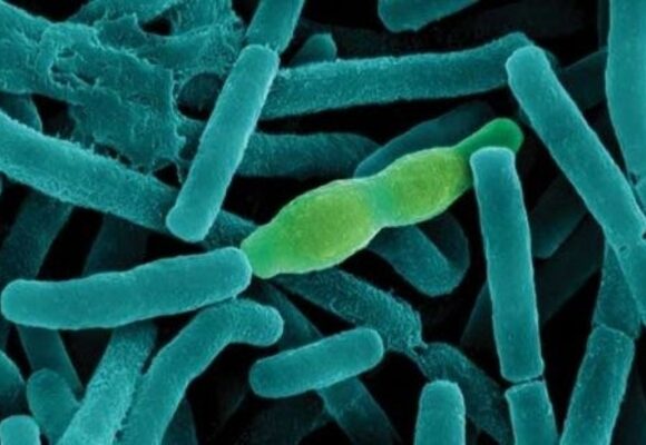 Сибирская язва. Симптомы и профилактика.