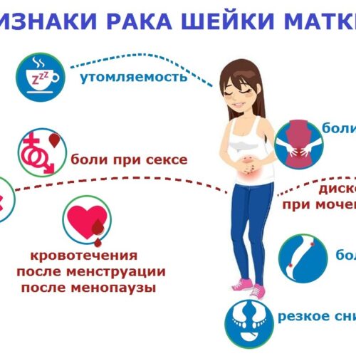 Профилактика рака шейки матки