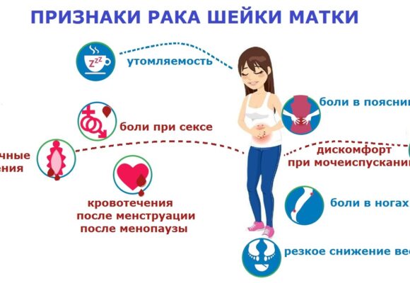 Профилактика рака шейки матки