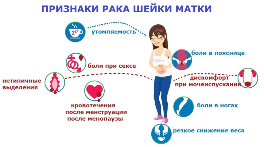 Профилактика рака шейки матки