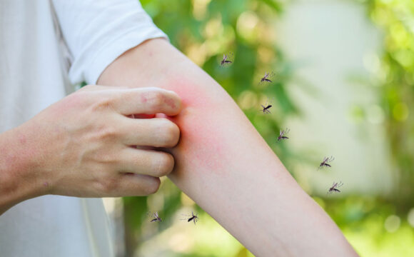 bzzzz1000 Как защитить себя от мошек?