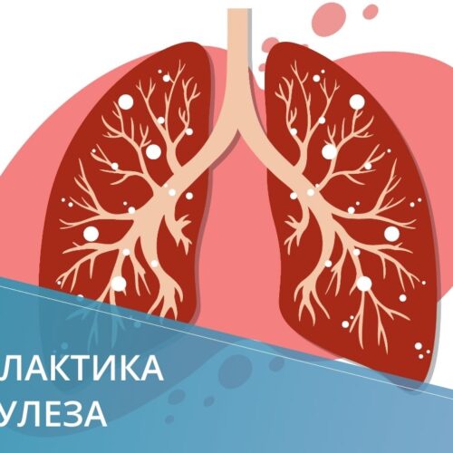 Профилактика туберкулеза