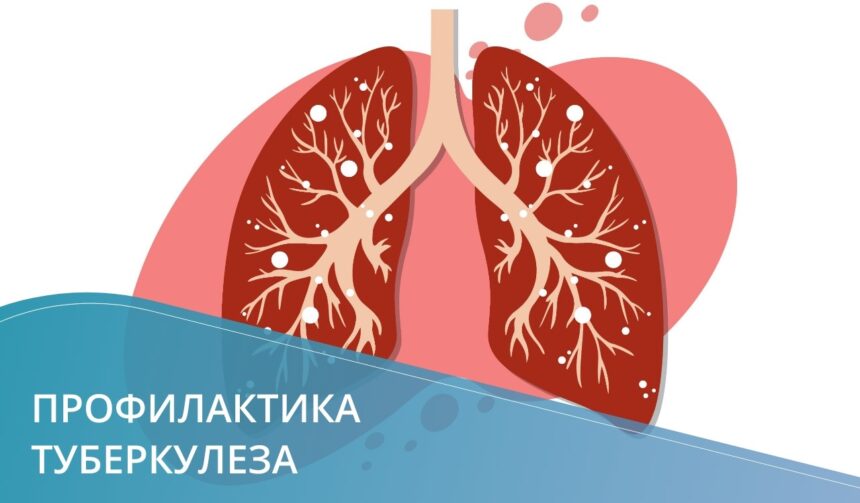Профилактика туберкулеза